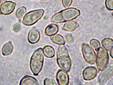 Common Mold Cladosporium